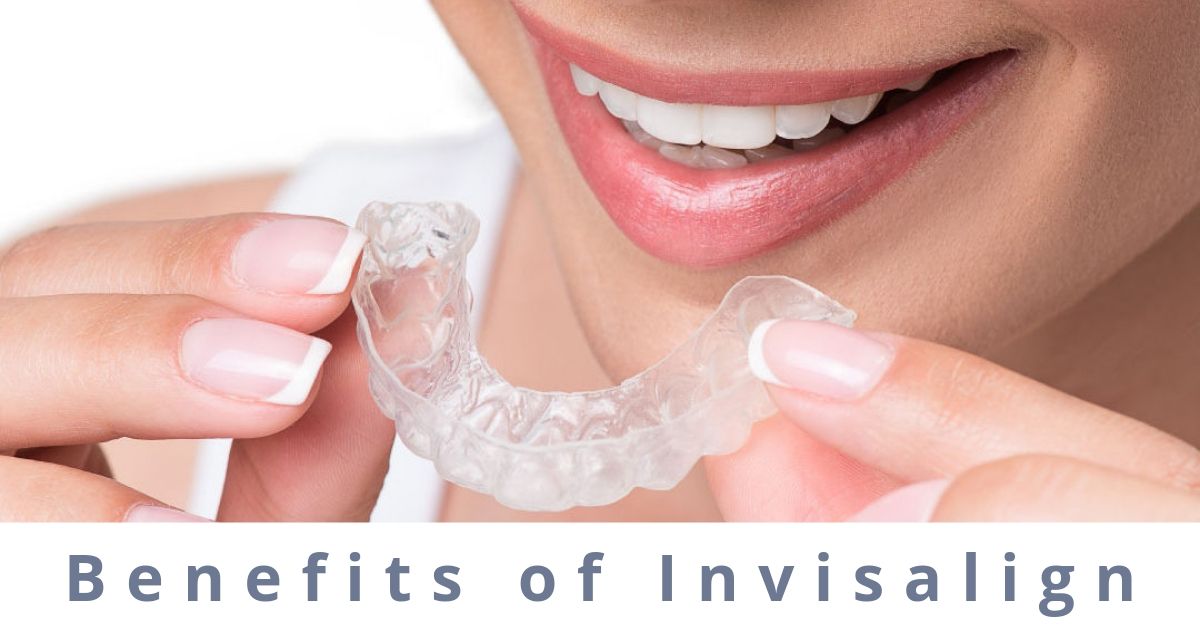 Benefits of Invisalign