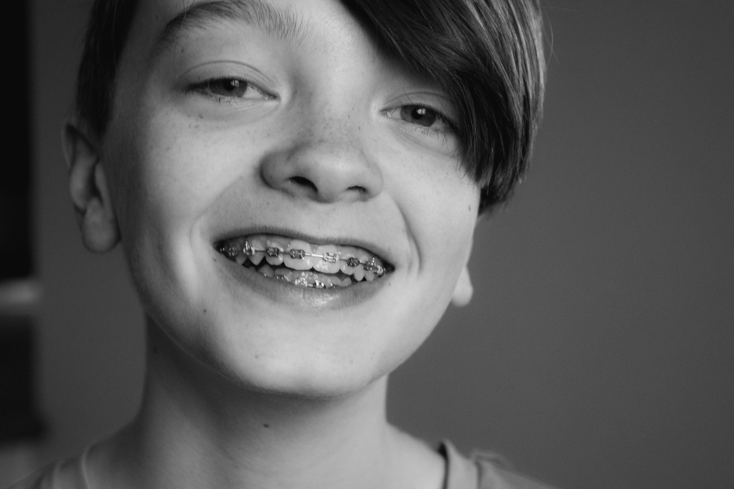 Boosting Speech Through Orthodontic Treatment: What Parents Should Know