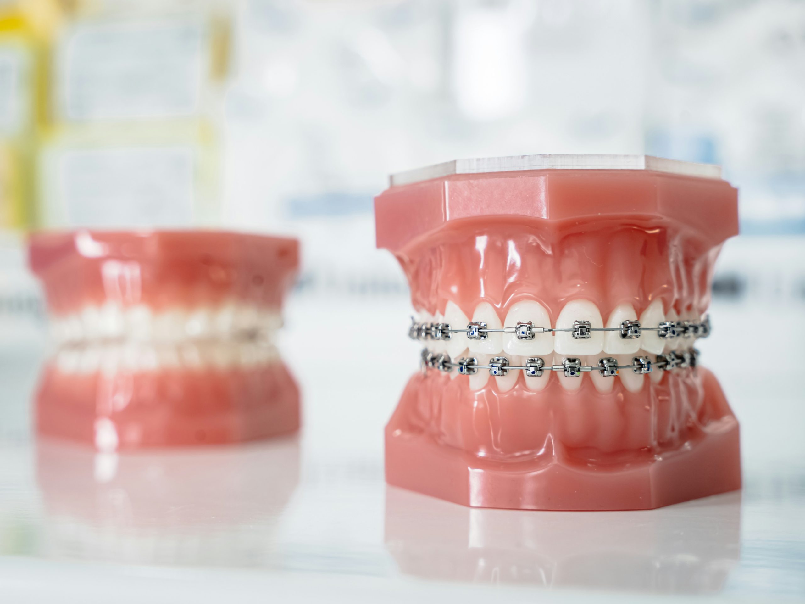 Braces-Friendly Recipes: Meals That Won’t Damage Appliances