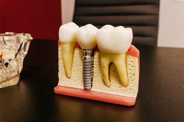 Specialist Orthodontists - GoClear